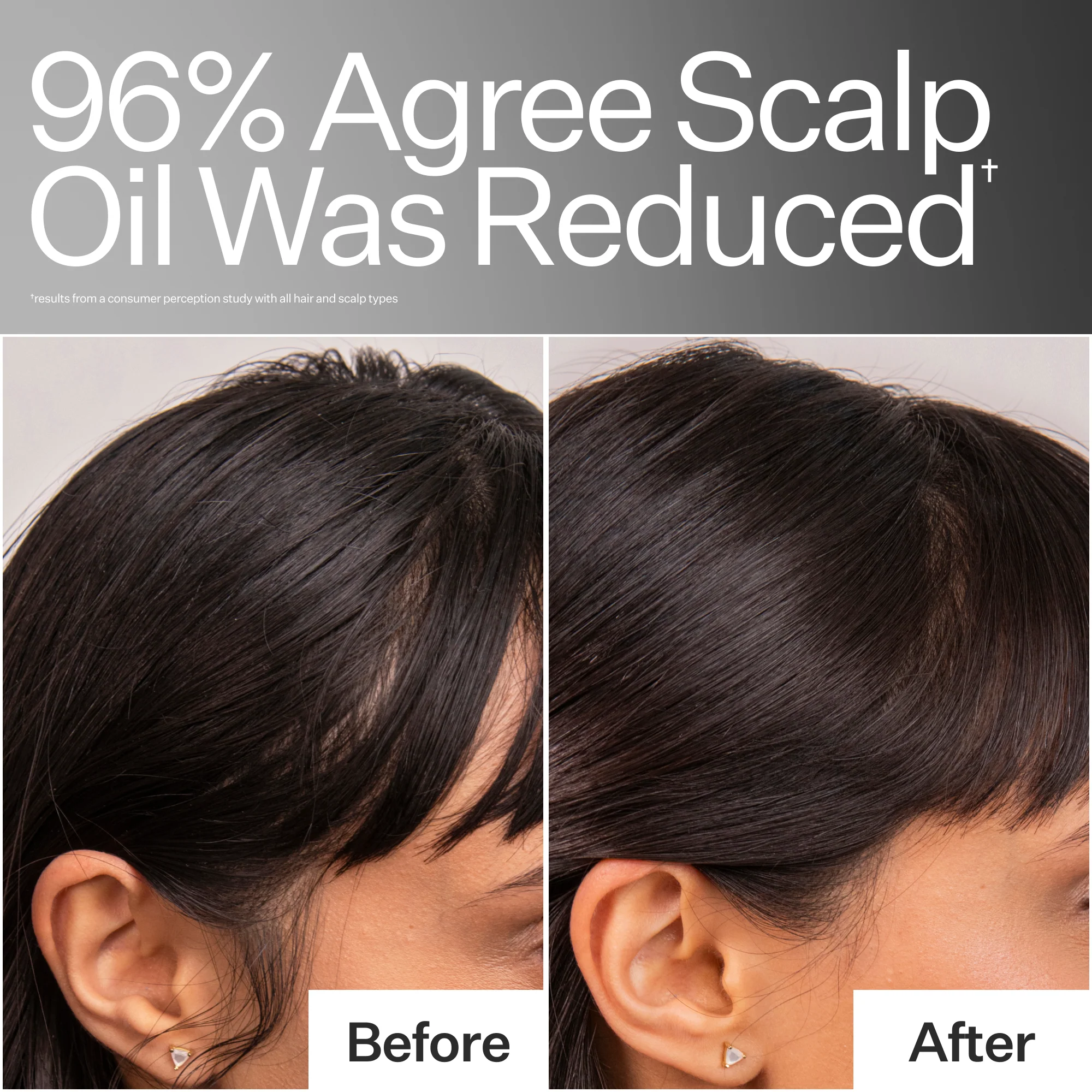 Act+Acre 4% Niacinamide Oily Scalp Serum - Image 3