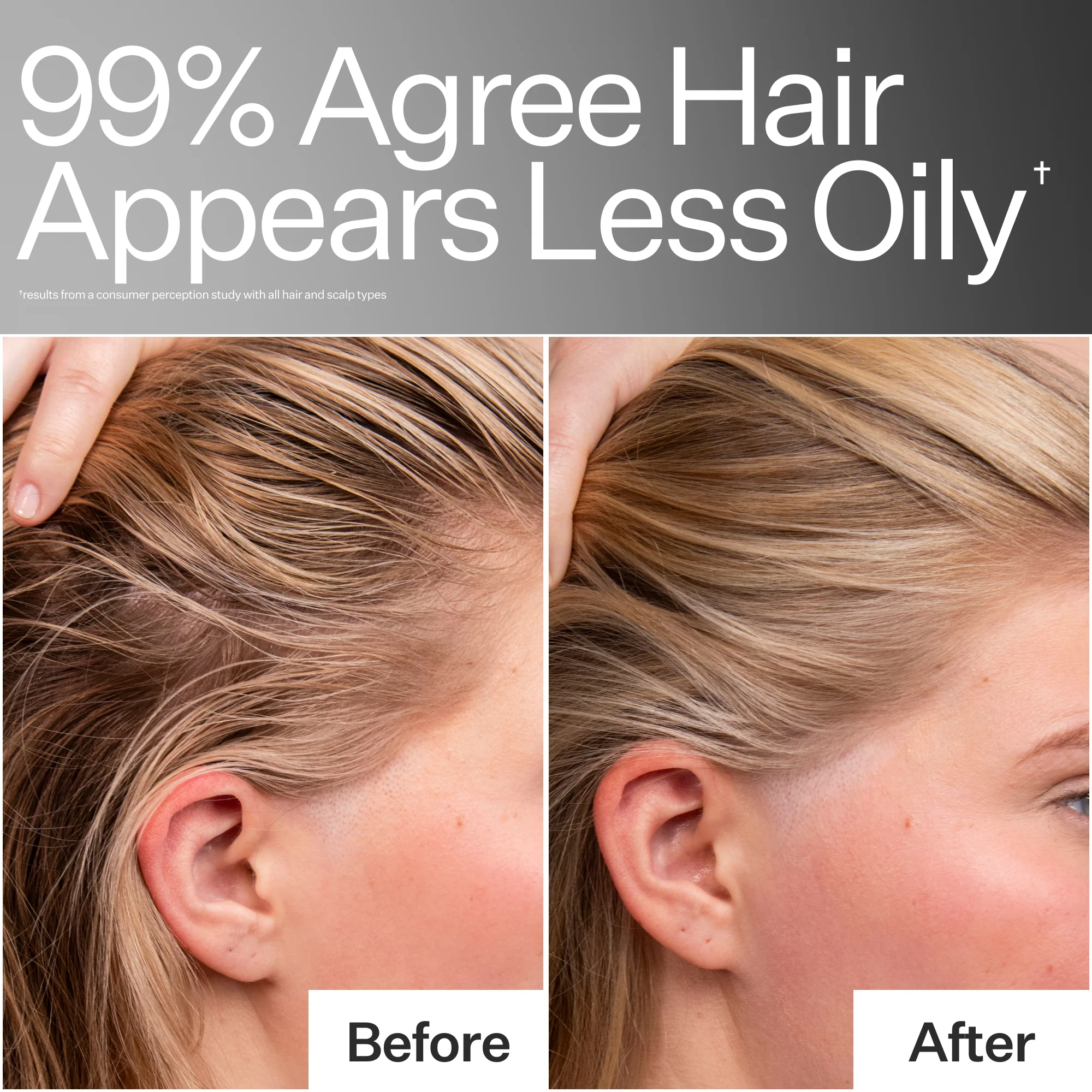 Act+Acre 4% Niacinamide Oily Scalp Serum - Image 8