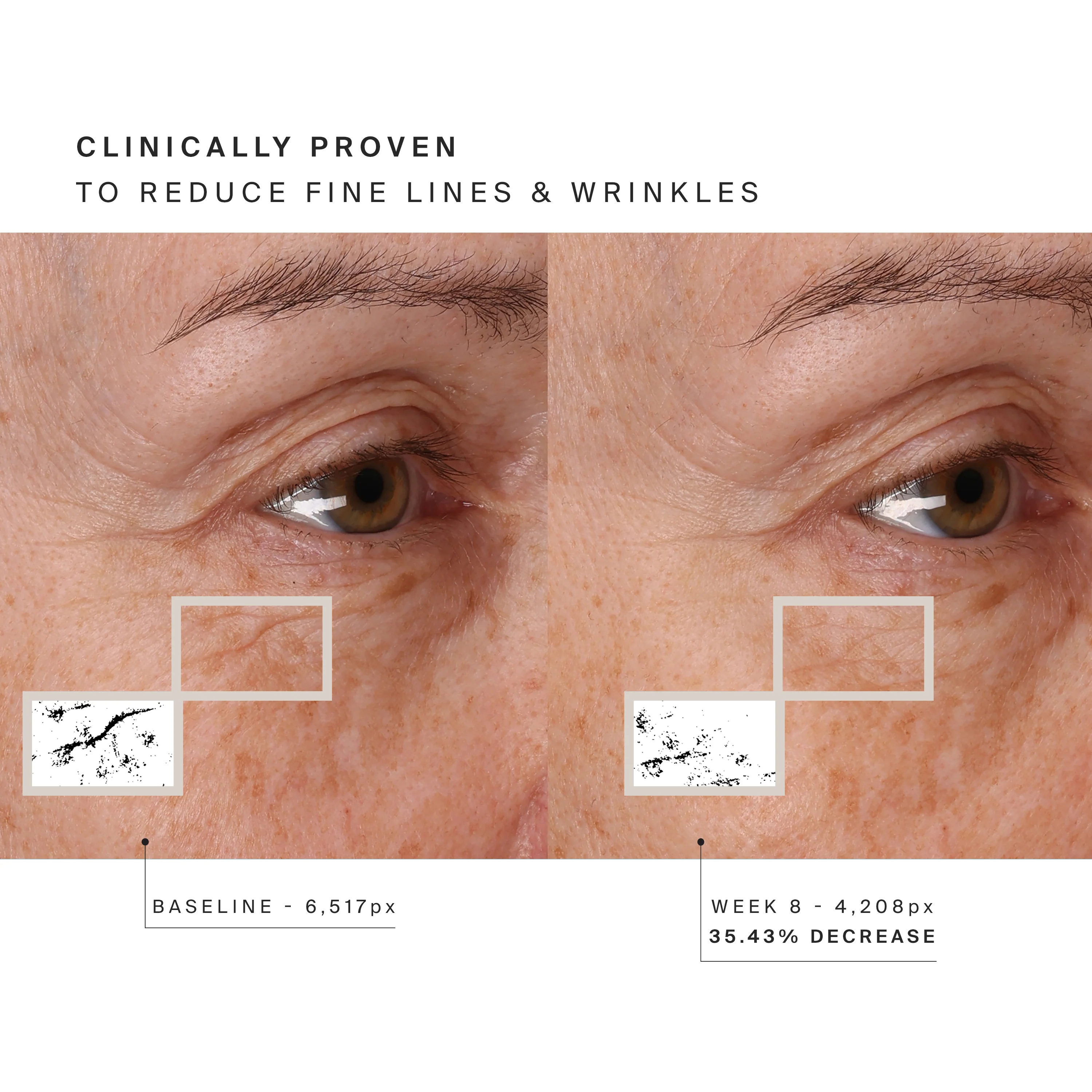 Higherdose Red Light Face Mask - Image 12