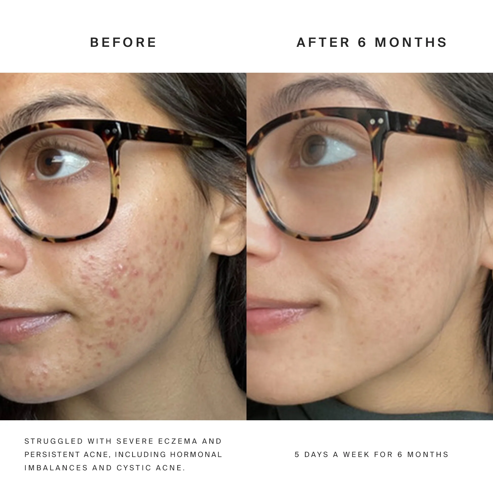 Higherdose Red Light Face Mask - Image 14
