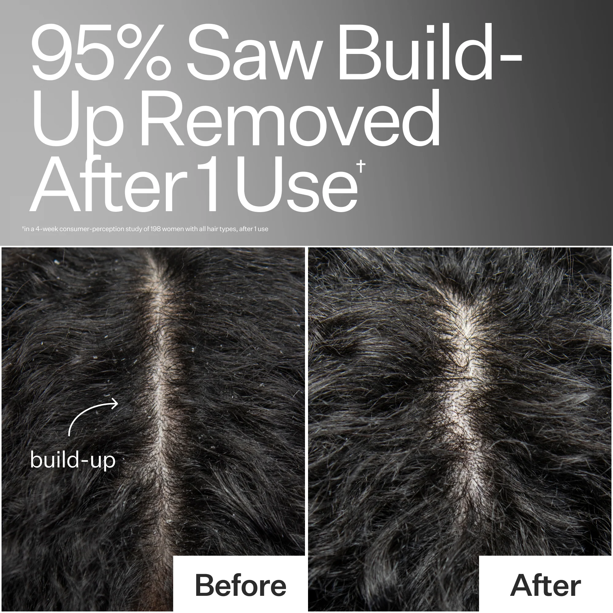 Scalp Detox - Image 4