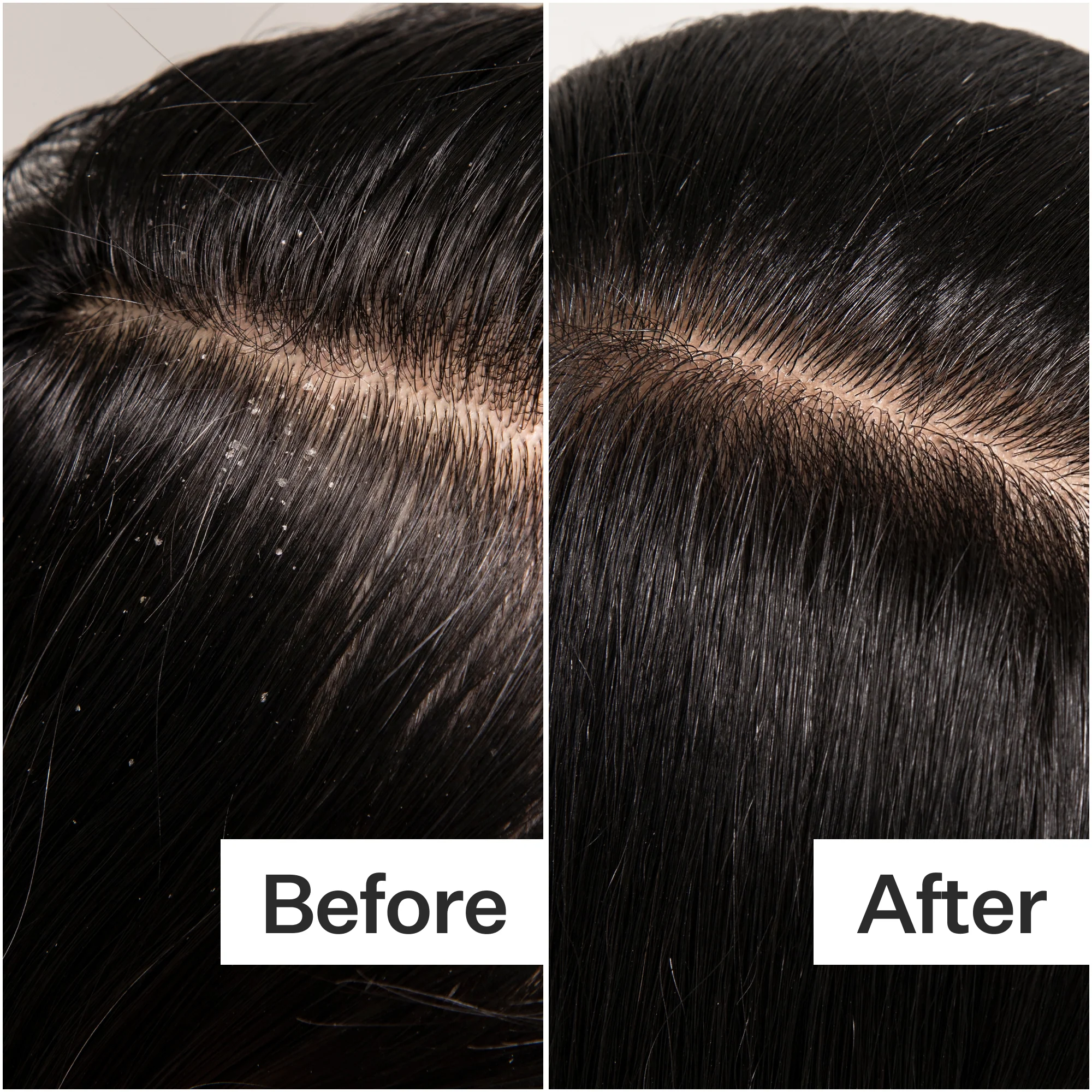 Scalp Detox - Image 7