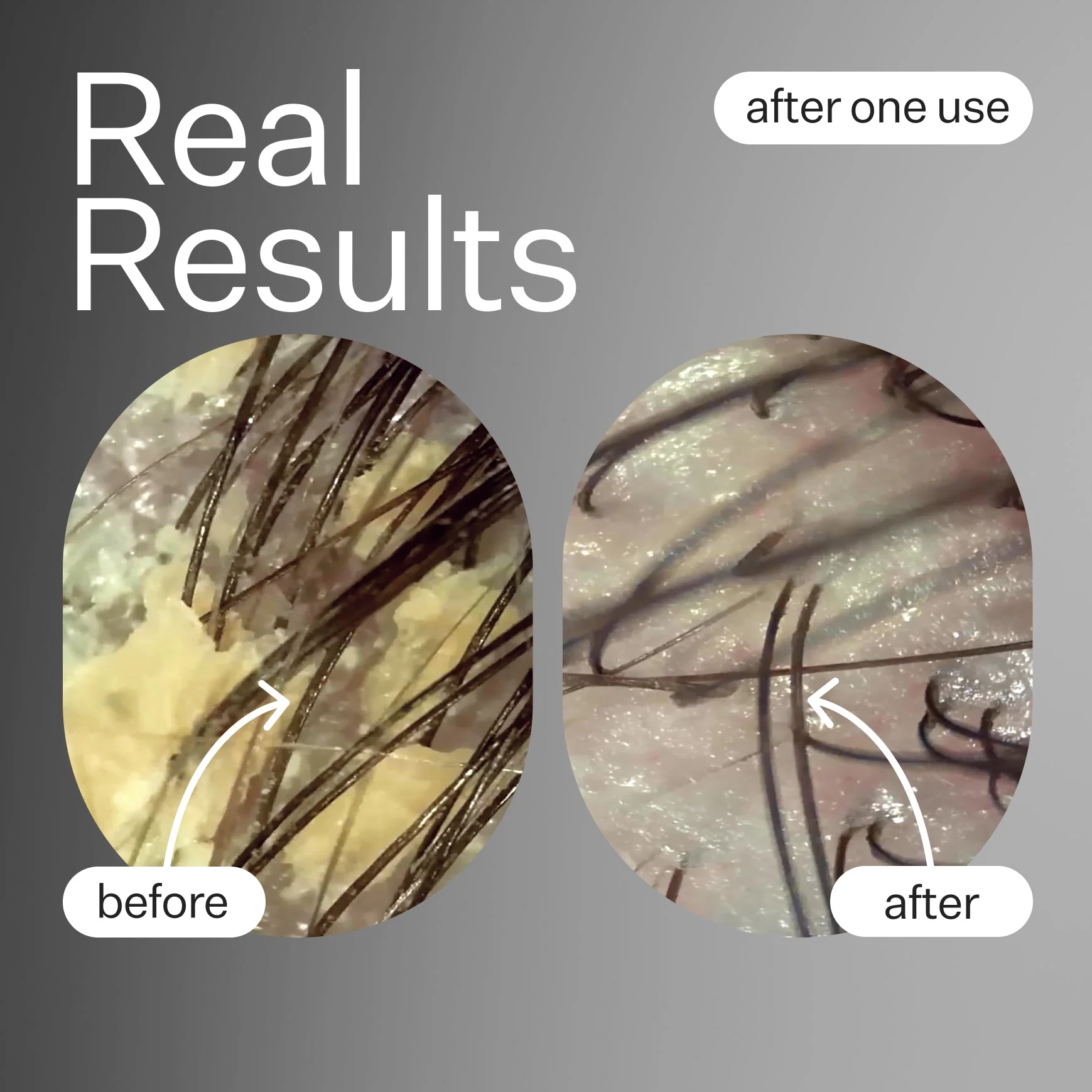 Scalp Renew - Image 3
