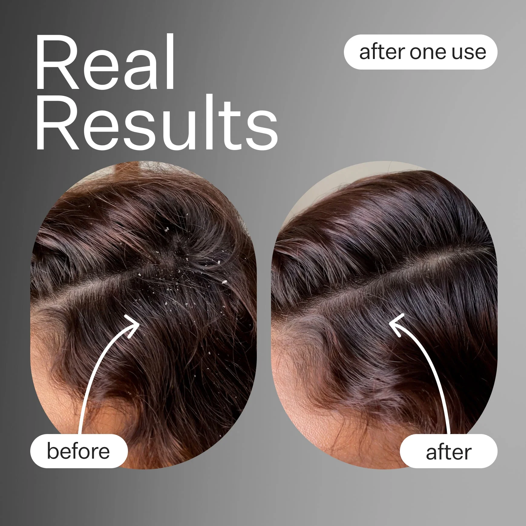 Scalp Renew - Image 4