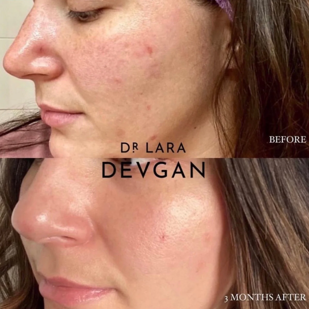 Dr. Devgan Vitamin C+B+E Ferulic Serum - Image 6