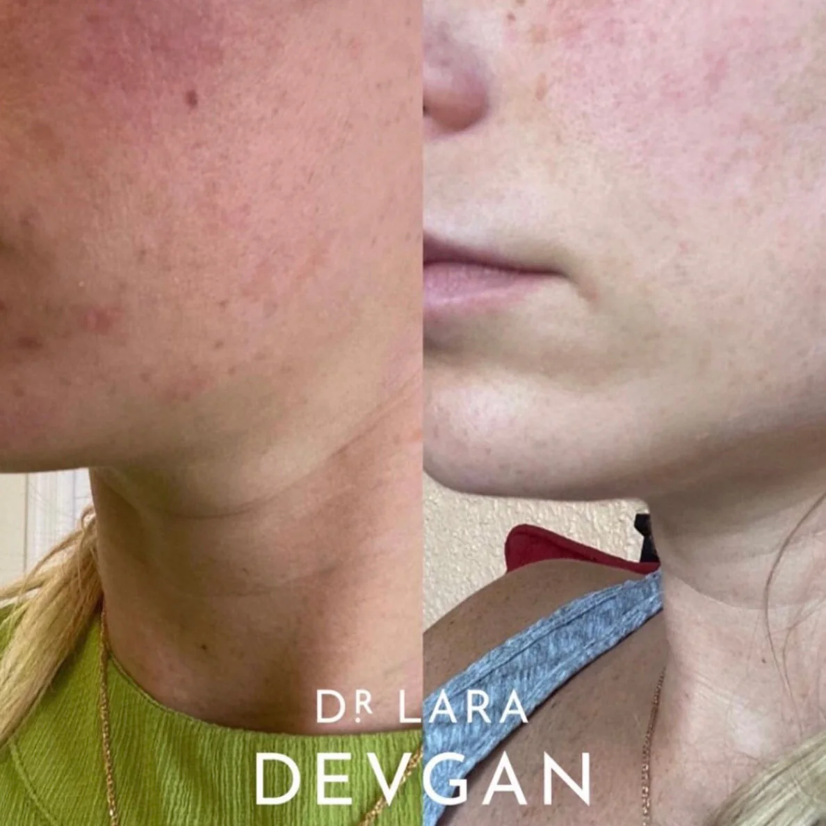 Dr. Devgan Vitamin C+B+E Ferulic Serum - Image 7