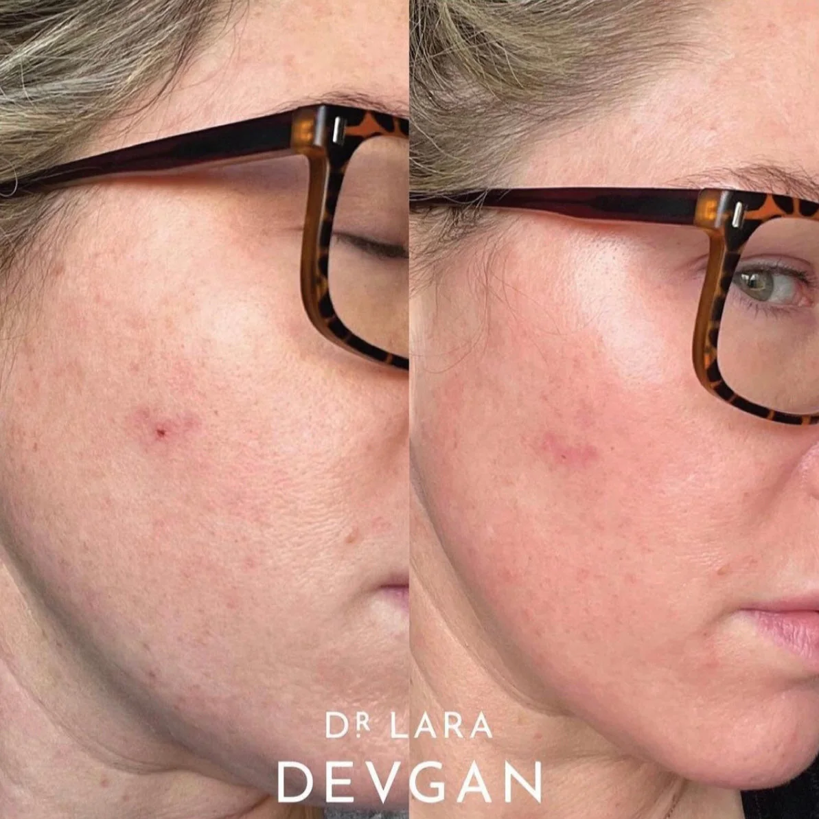 Dr. Devgan Vitamin C+B+E Ferulic Serum - Image 8
