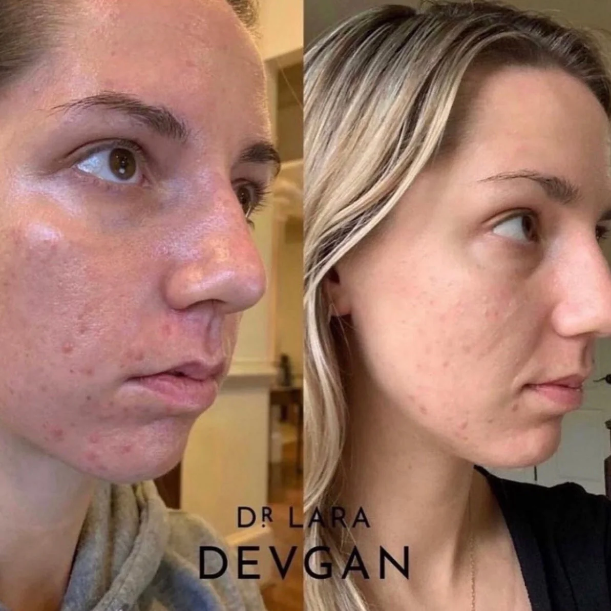 Dr. Devgan Vitamin C+B+E Ferulic Serum - Image 9